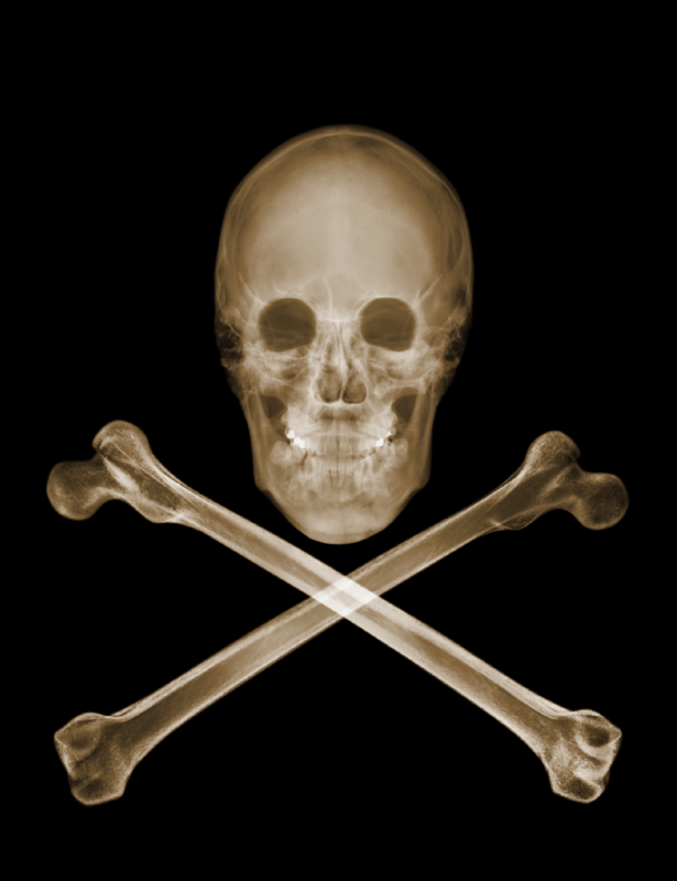 skull